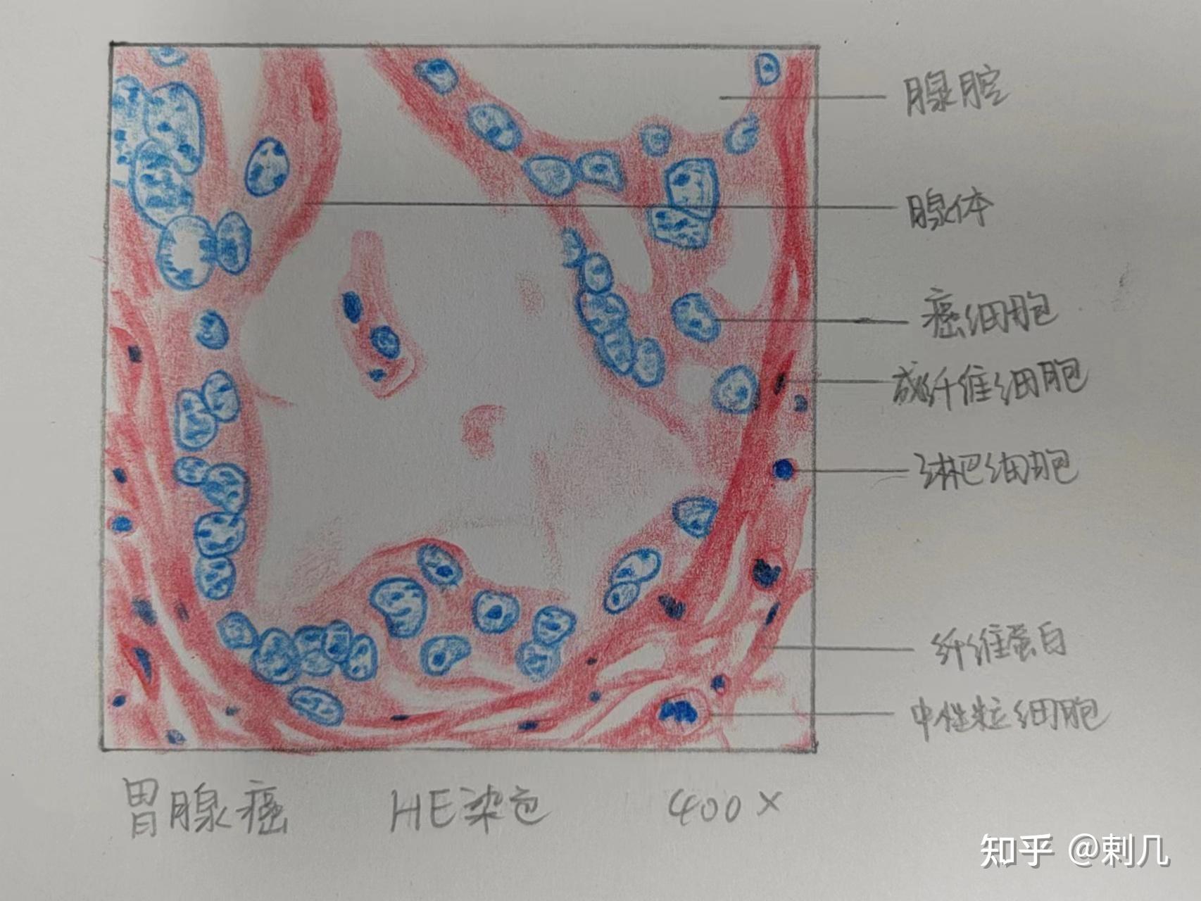 病理绘图手绘图图片