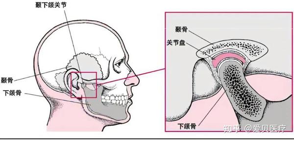 正颌那些事儿Ⅴ:颞下颌关节紊乱与正颌治疗 - 知乎