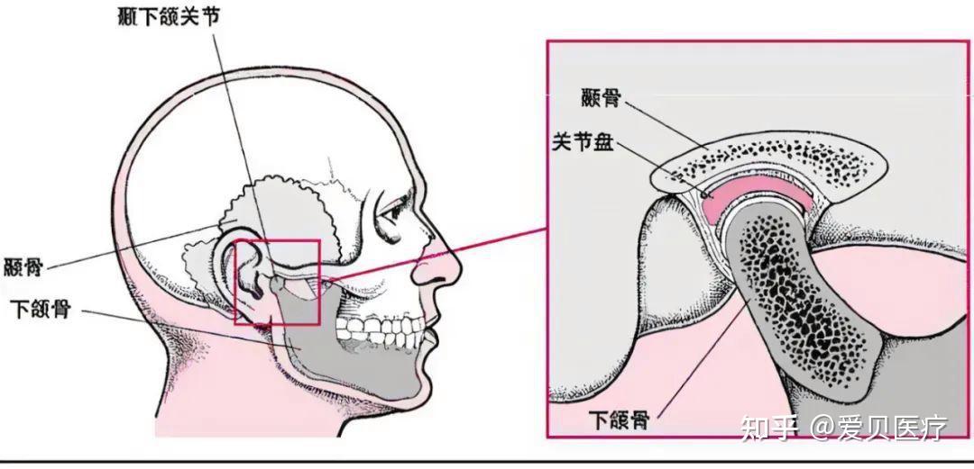 正颌那些事儿Ⅴ：颞下颌关节紊乱与正颌治疗 - 知乎
