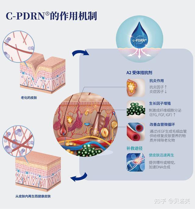 美顏科普水光針嬰兒針童顏水凝有什麼區別