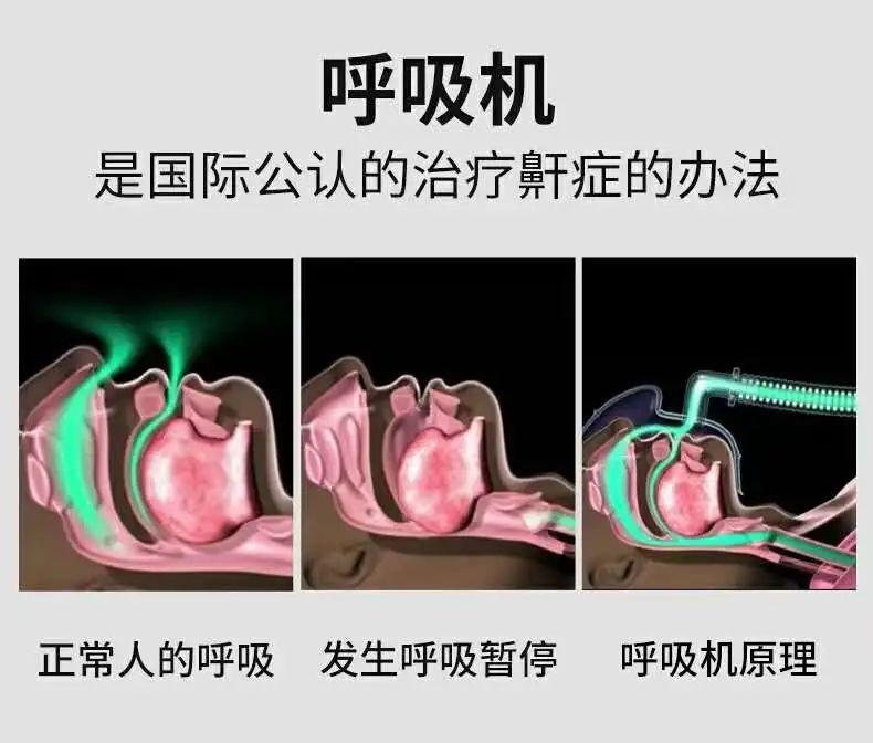 打鼾原理图片