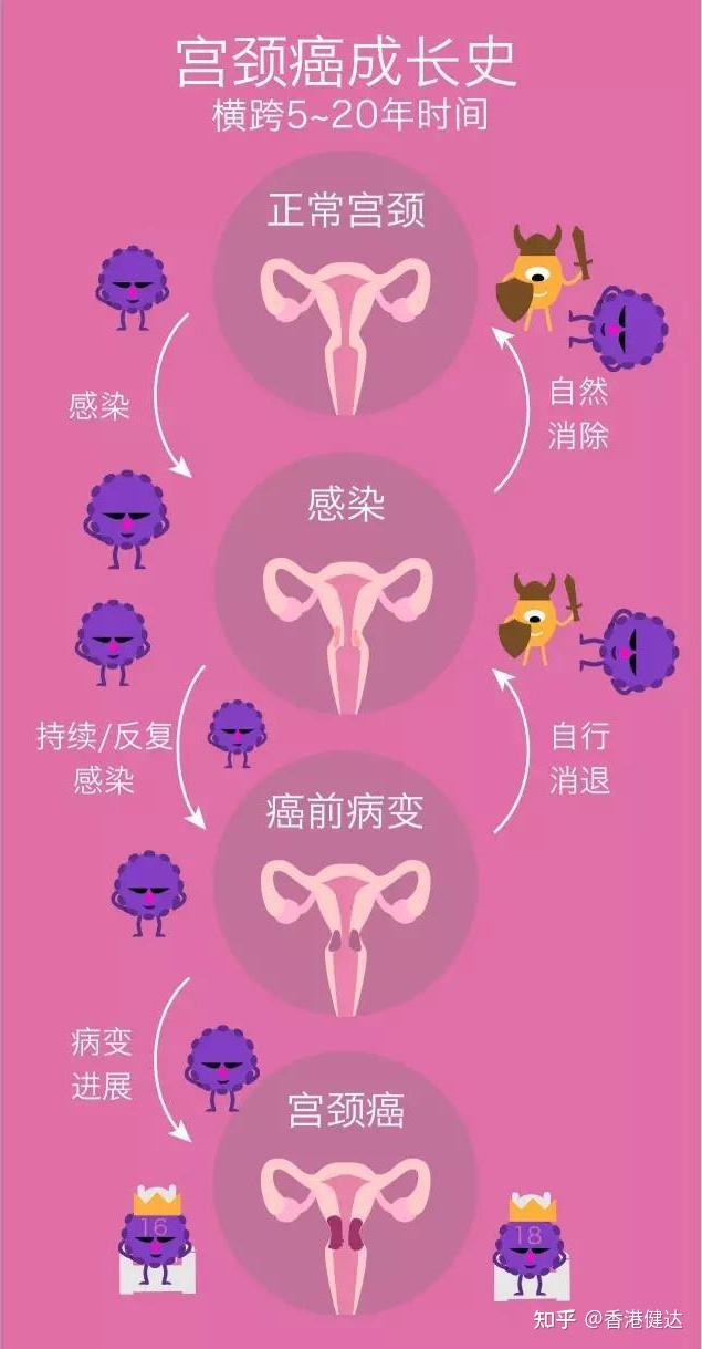 高危型hpv的持續感染是主要危險因素