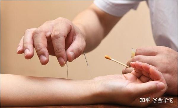 什么是中医放血疗法?放血疗法有什么功效? - 知乎