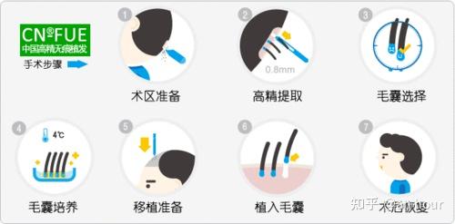 【生发技术】独特之处！！ - 知乎