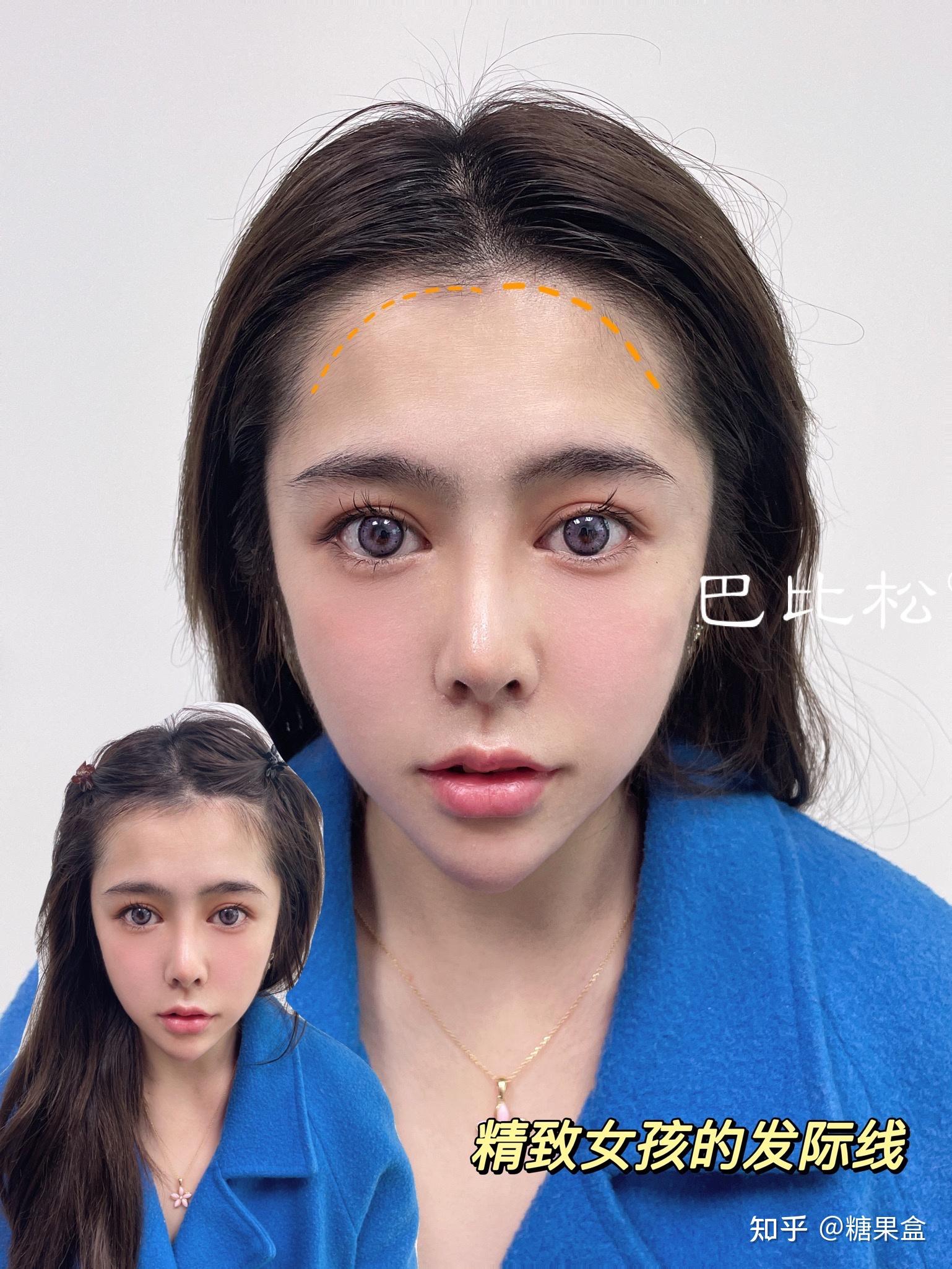 分享我的纹发际线教程 - 知乎