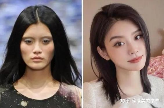 从苦相脸到幼态脸,奚梦瑶到底动了哪里?【善美宁微整形】 - 知乎