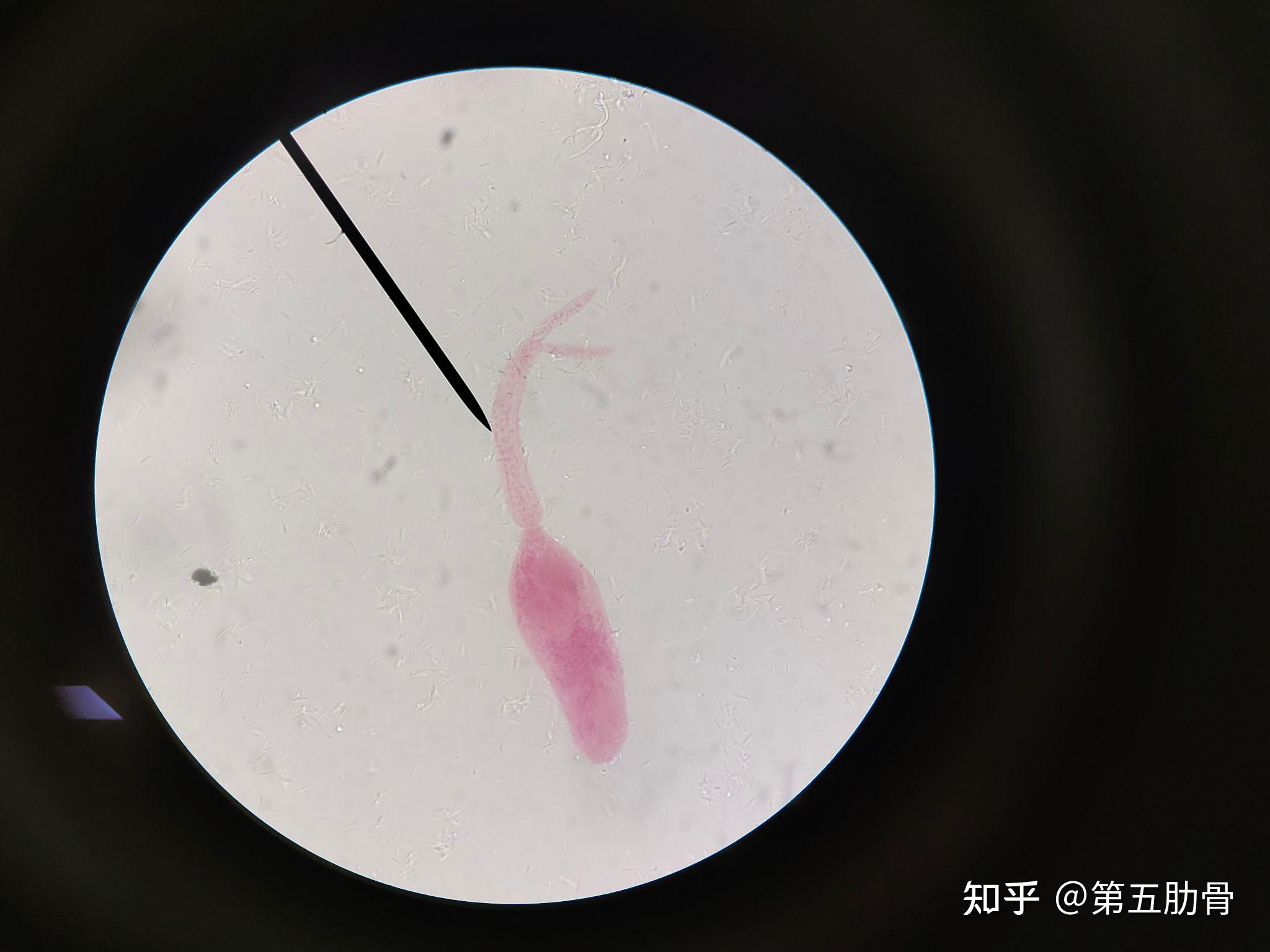 医学寄生虫学镜下实拍