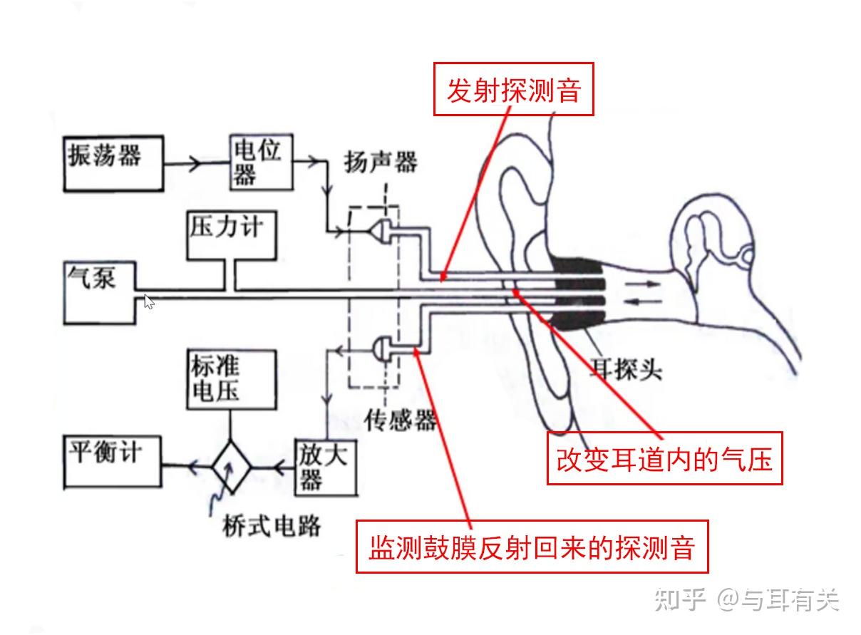 声导抗之鼓室图原理介绍及结果解读 - 知乎
