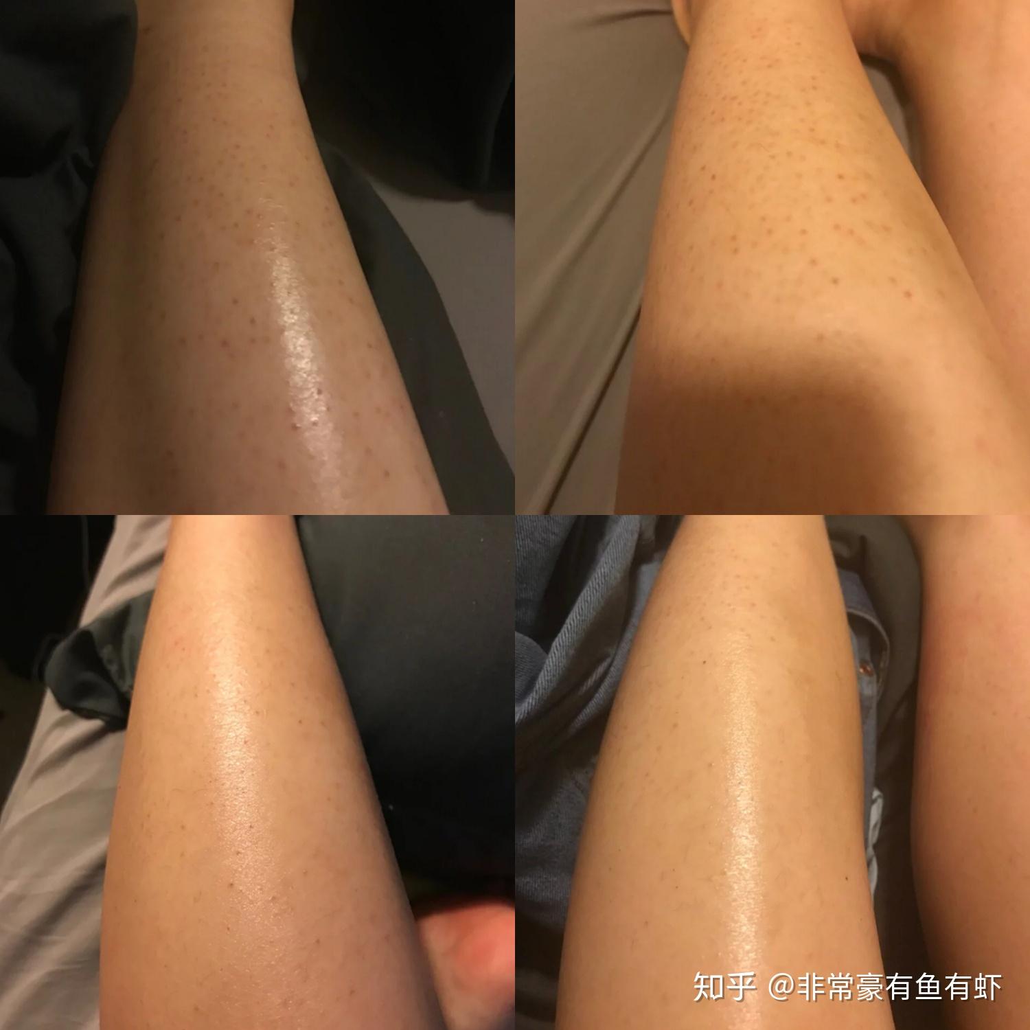 鸡皮肤有问题怎么办(鸡皮肤有问题怎么办图片)