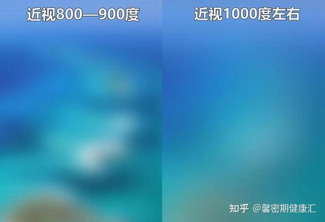 正常视力到千度近视的区别几张图告诉你这些要点需重视