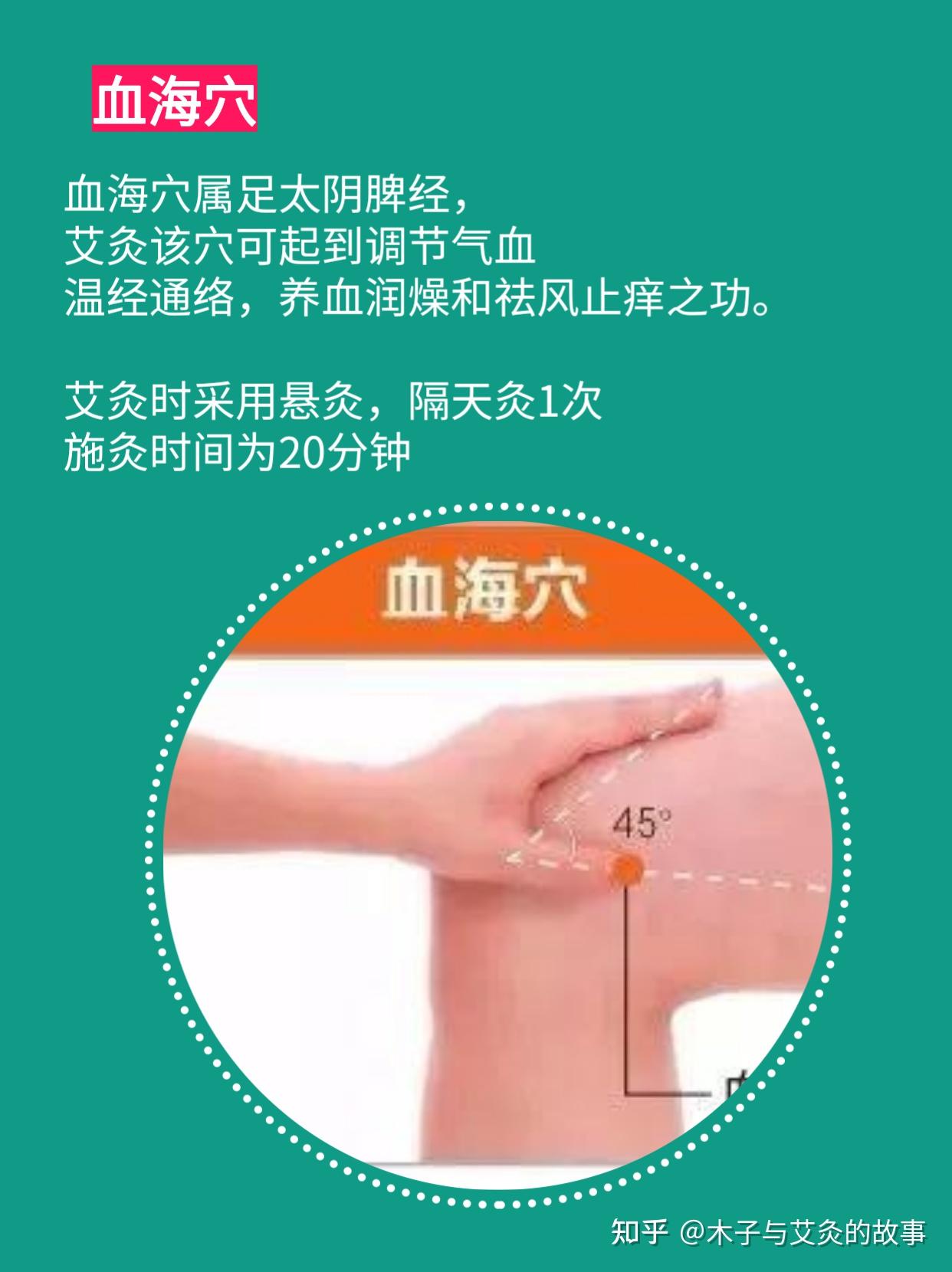 我笑著說又過敏啦,第二天拿了些艾灸條送過去,先灸了一下血海40分鐘