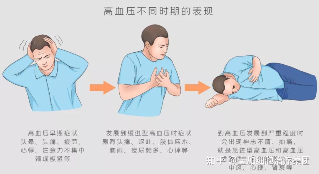 临床研究 | 间充质干细胞治疗高血压的3大原理