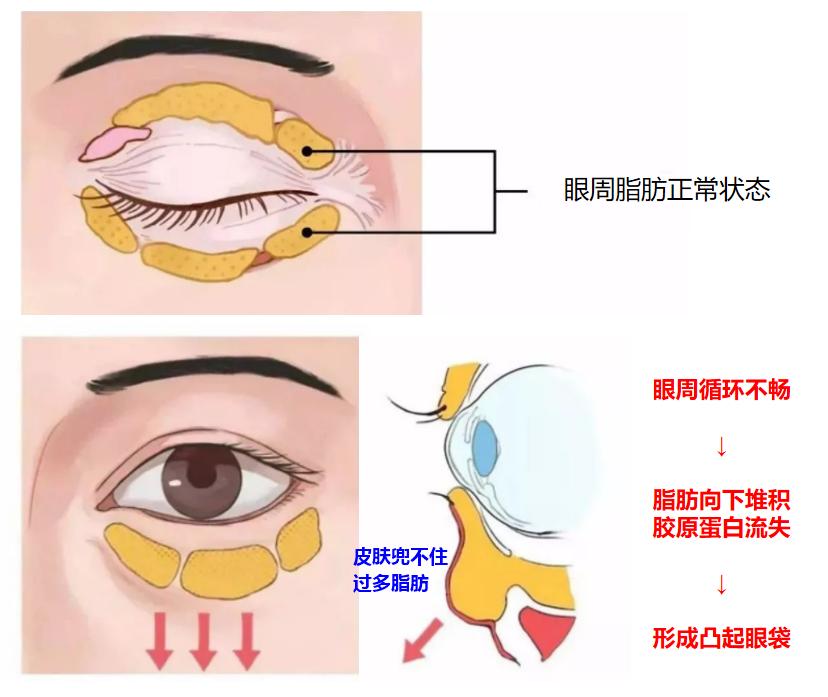 v2-e973cf2da4b34484d6f444dbc15544e3_r.jpg