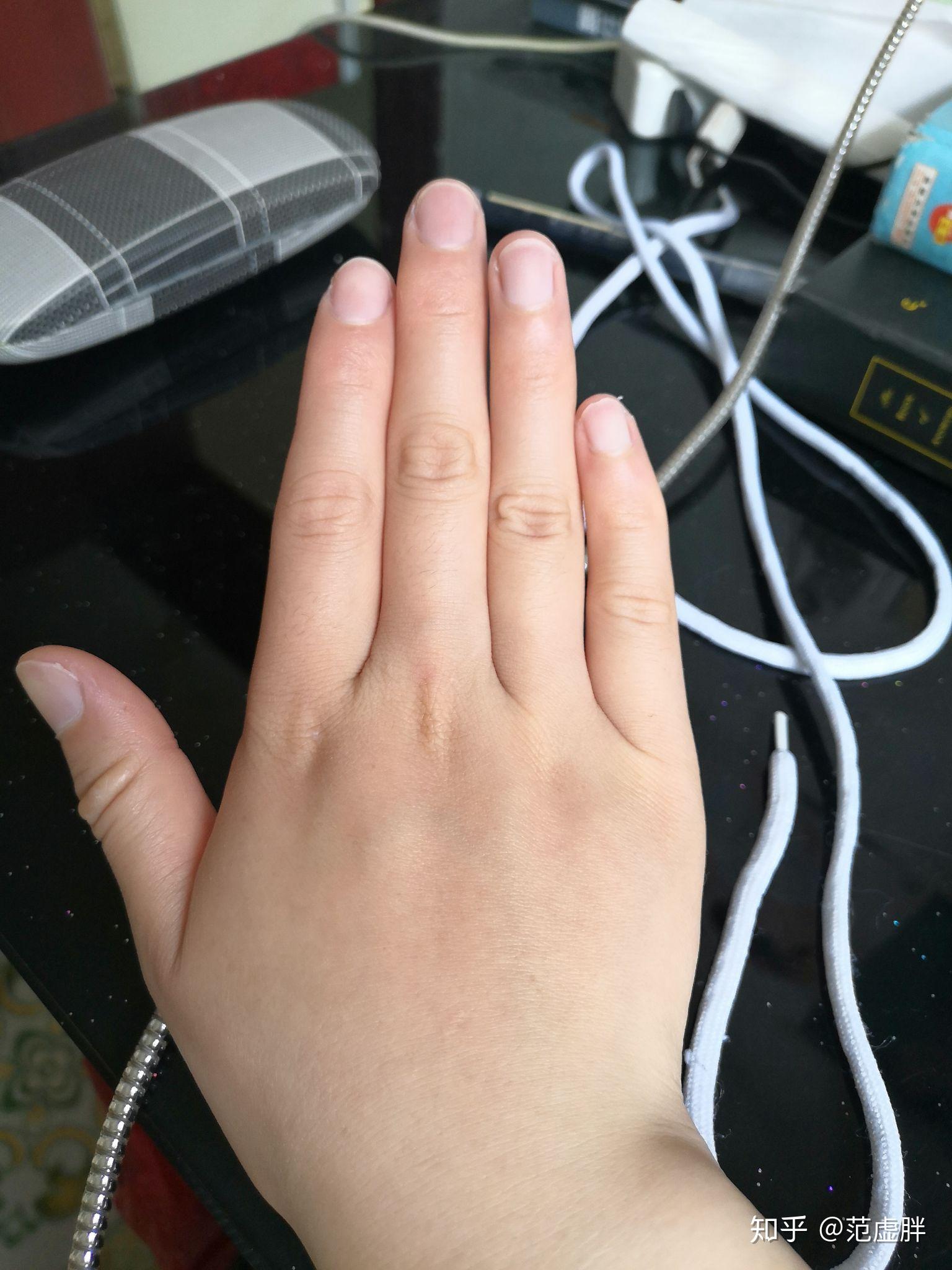 我的手又短又粗又胖还有希望变的又长又细吗