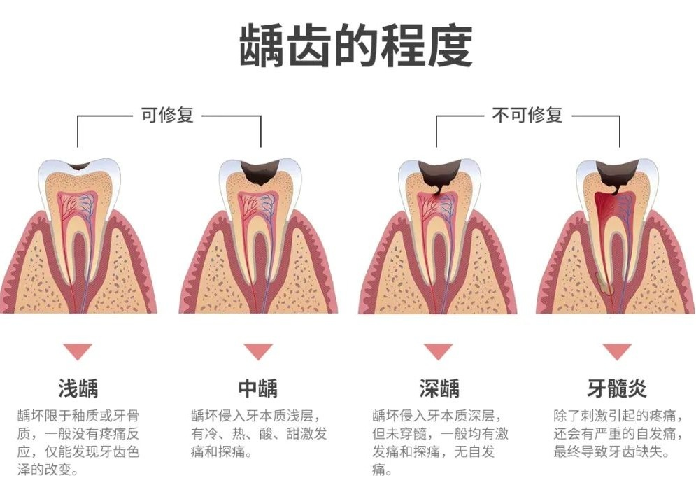 牙齿缺损了怎么办,有哪些修复方式? - 知乎