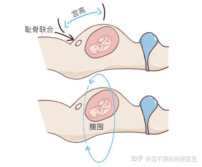 孕14周子宫位置示意图图片