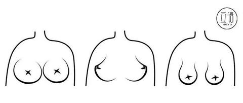 听我的,你的胸型要挑这种内衣 mp.weixin.qq.com