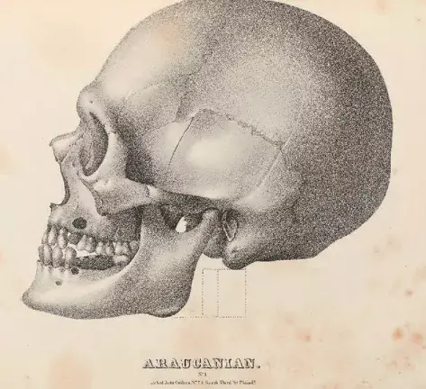 被种族主义科学家收集的51个头骨,每一个都是痛苦面具