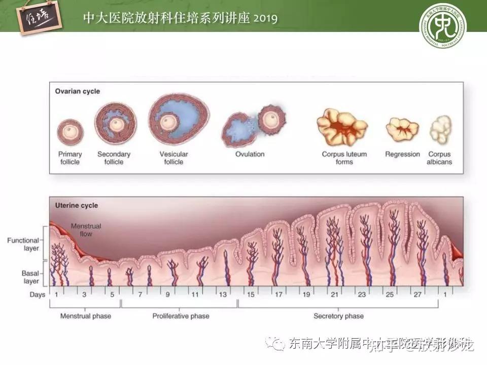 子宫详细解剖及磁共振信号分析 - 知乎