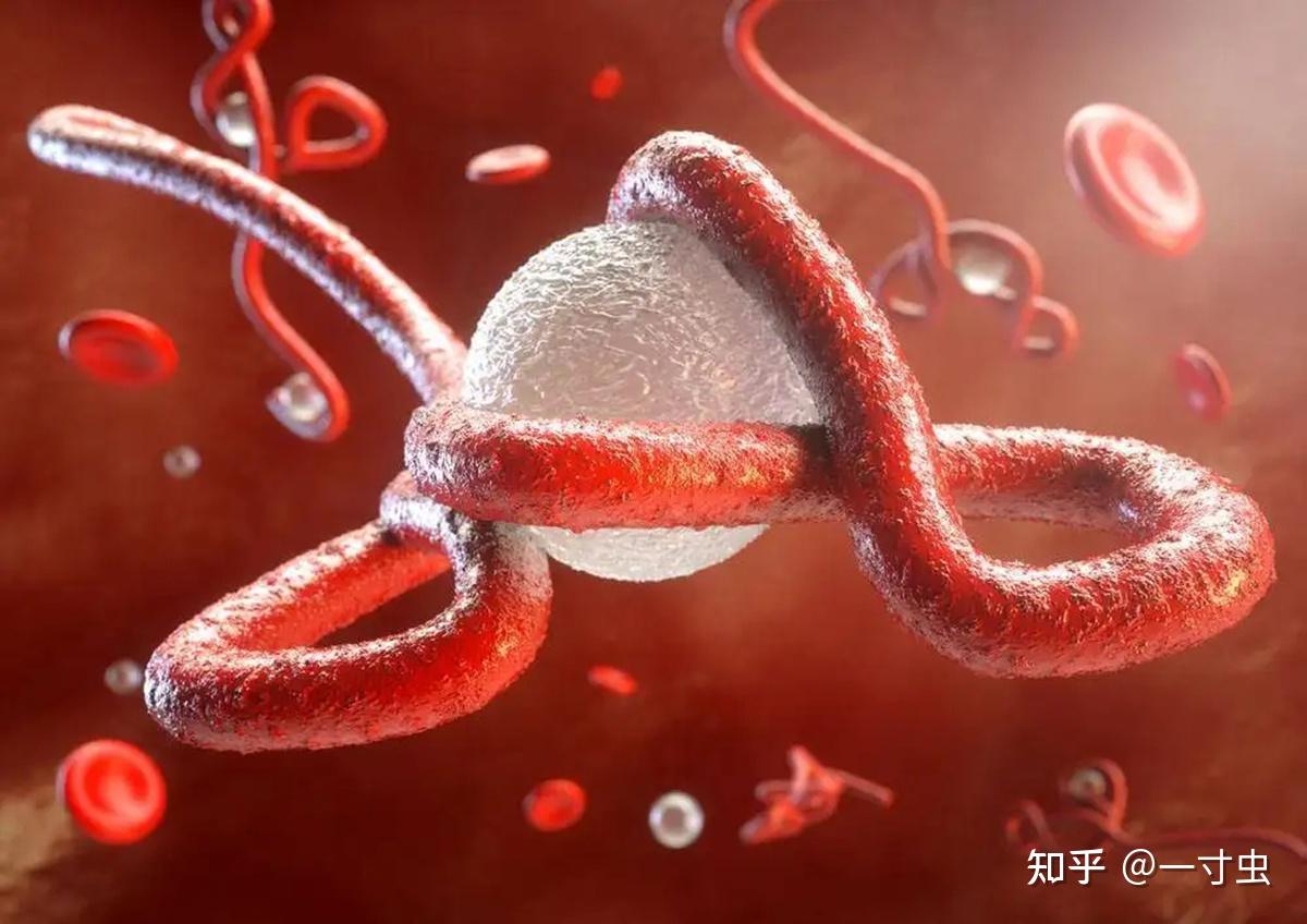 埃博拉病毒3-ODDBA社区