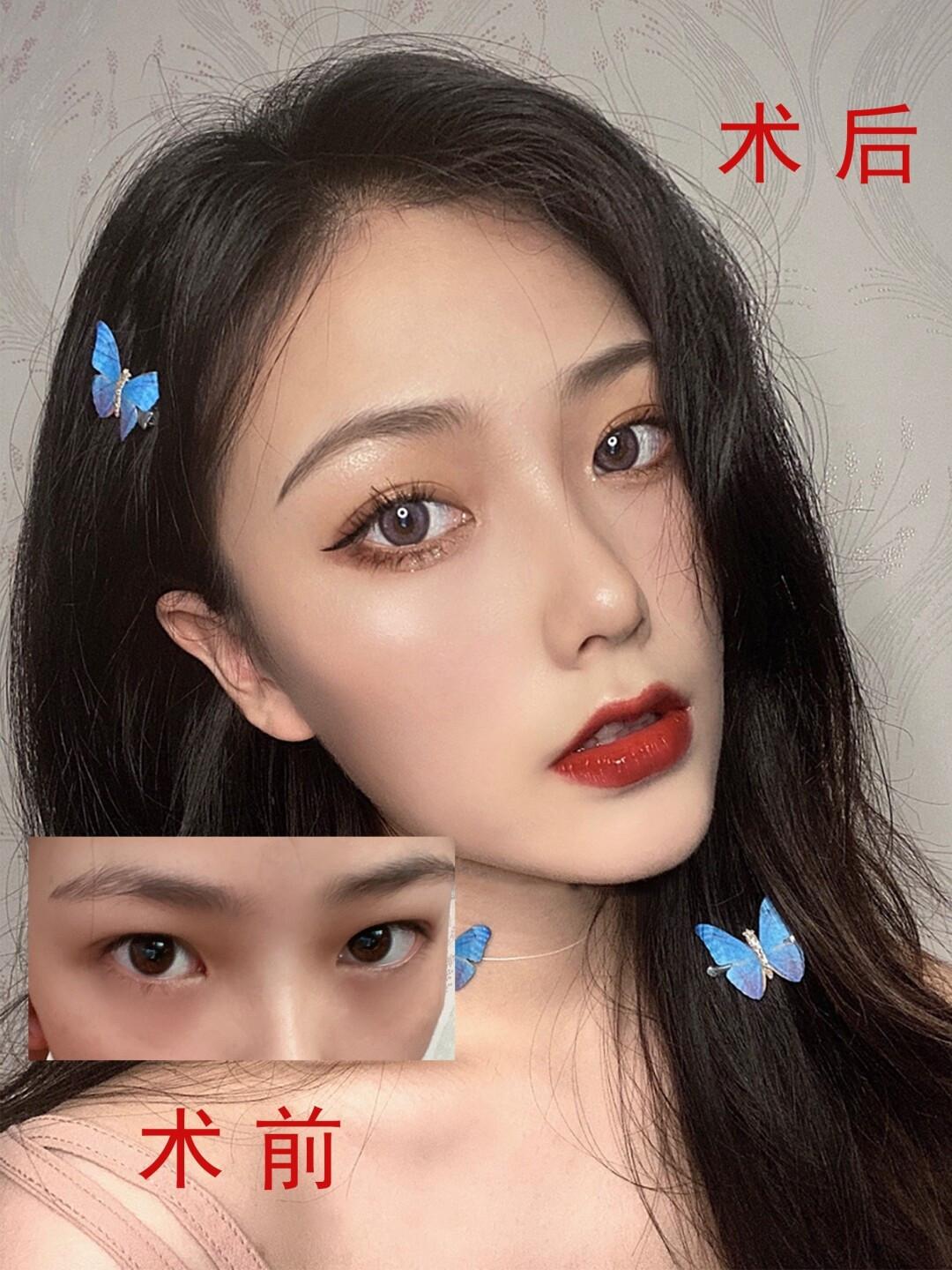 v2-ea363fb1858564a711c7b643e6d69fc1_1440w.jpg?source=172ae18b