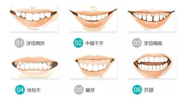 v2-ea532668633ffc20240d34c21767cc69_1440w.jpg?source=172ae18b