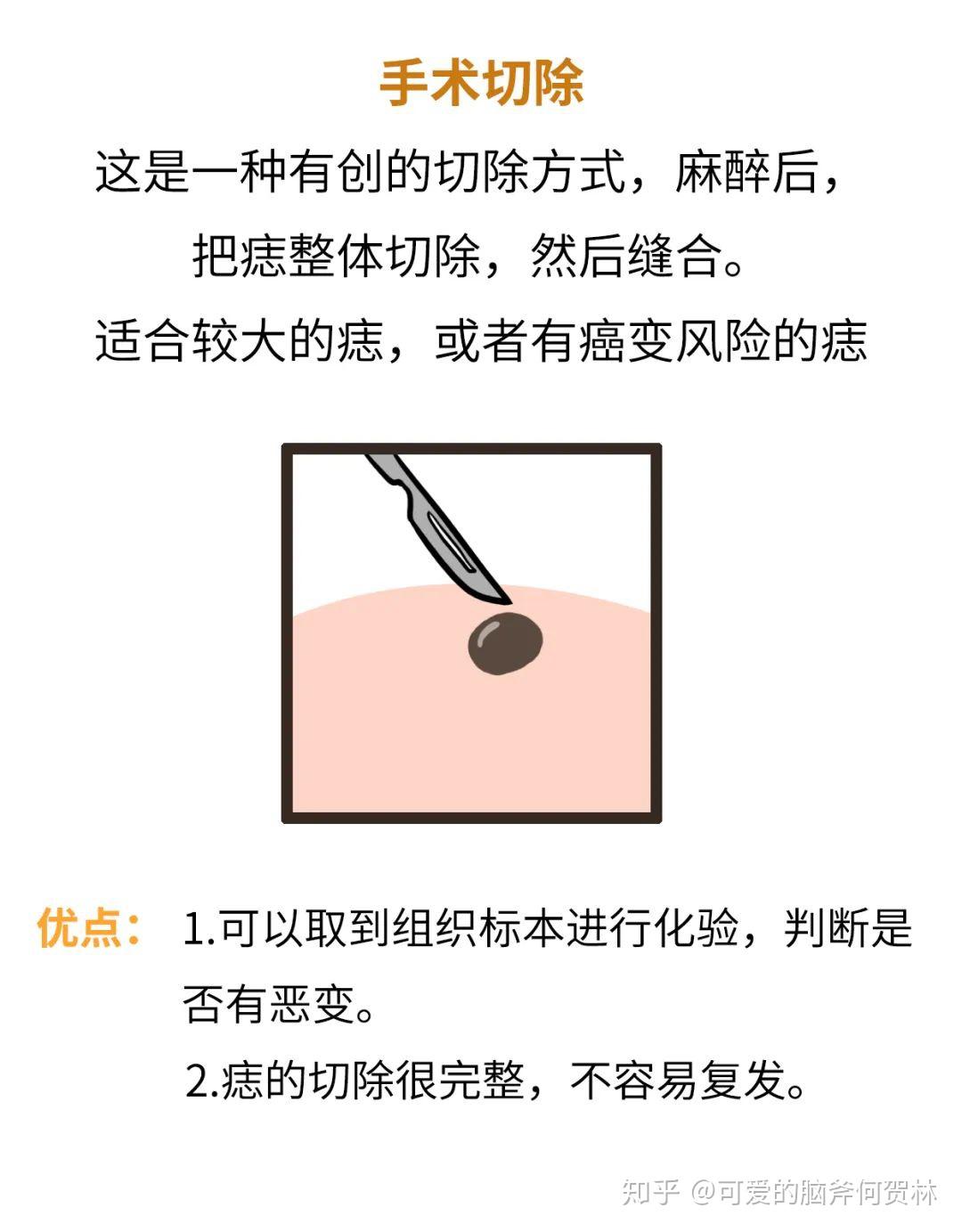 v2-ead17af8f31574df837d605ff636f97b_r.jpg