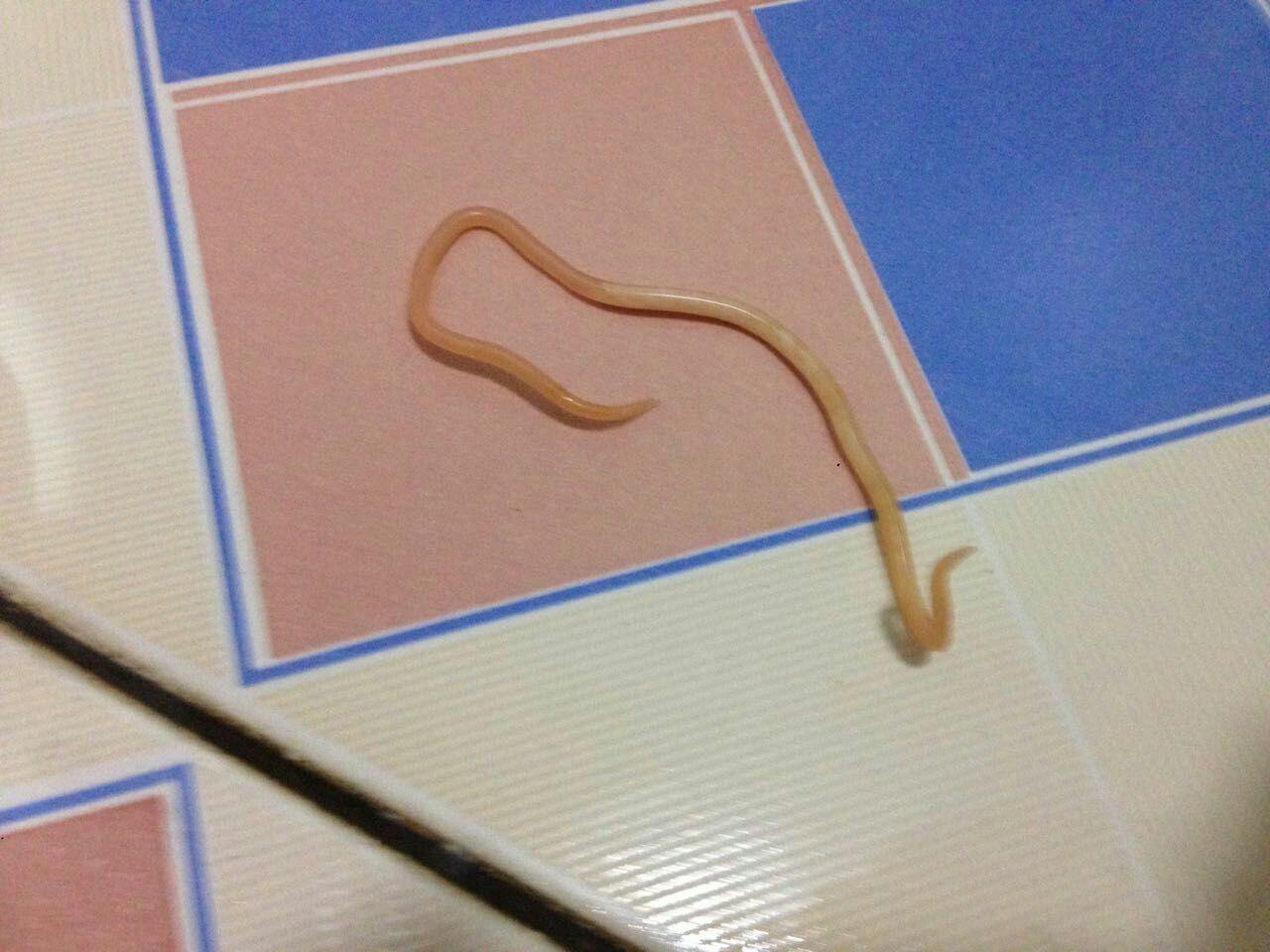 今天上厕所拉了好大一条蛔虫出来怎么办