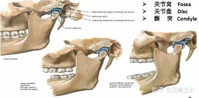 顳下頜關節的基本解剖結構如下圖:髁突在關節窩裡進行轉動(rotation)
