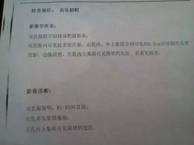 鉬靶圖像上的鈣化情況有:片狀鈣化,簇狀鈣化,細點狀微小鈣化等.