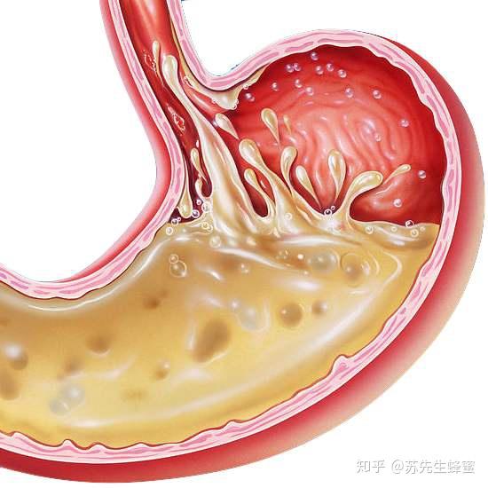 你知道怎麼吃蜂蜜可以修復胃黏膜嗎?蜂蜜怎樣吃修復胃粘膜?