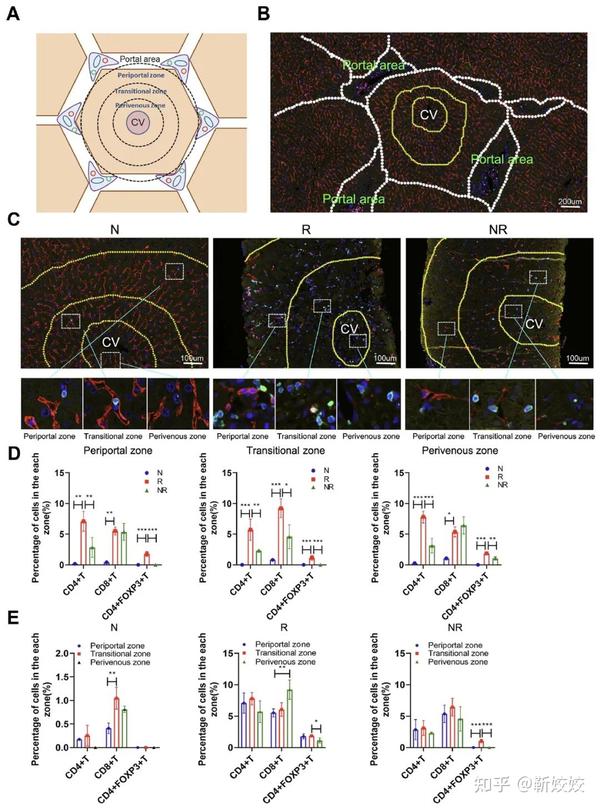 肝移植组织微环境研究，多重荧光免疫组化有这些新发现！ - 知乎