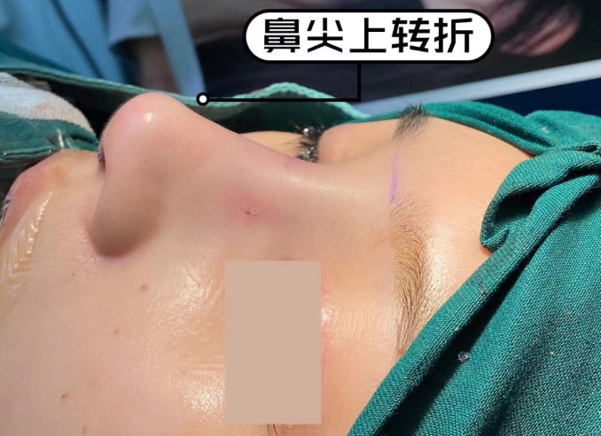 v2-ebe708cf2e52196a1b4925ddcf48386b_r.jpg