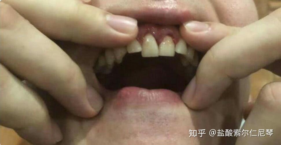 v2-ec057b07df2ca3b550d282eeec678f63_r.jpg