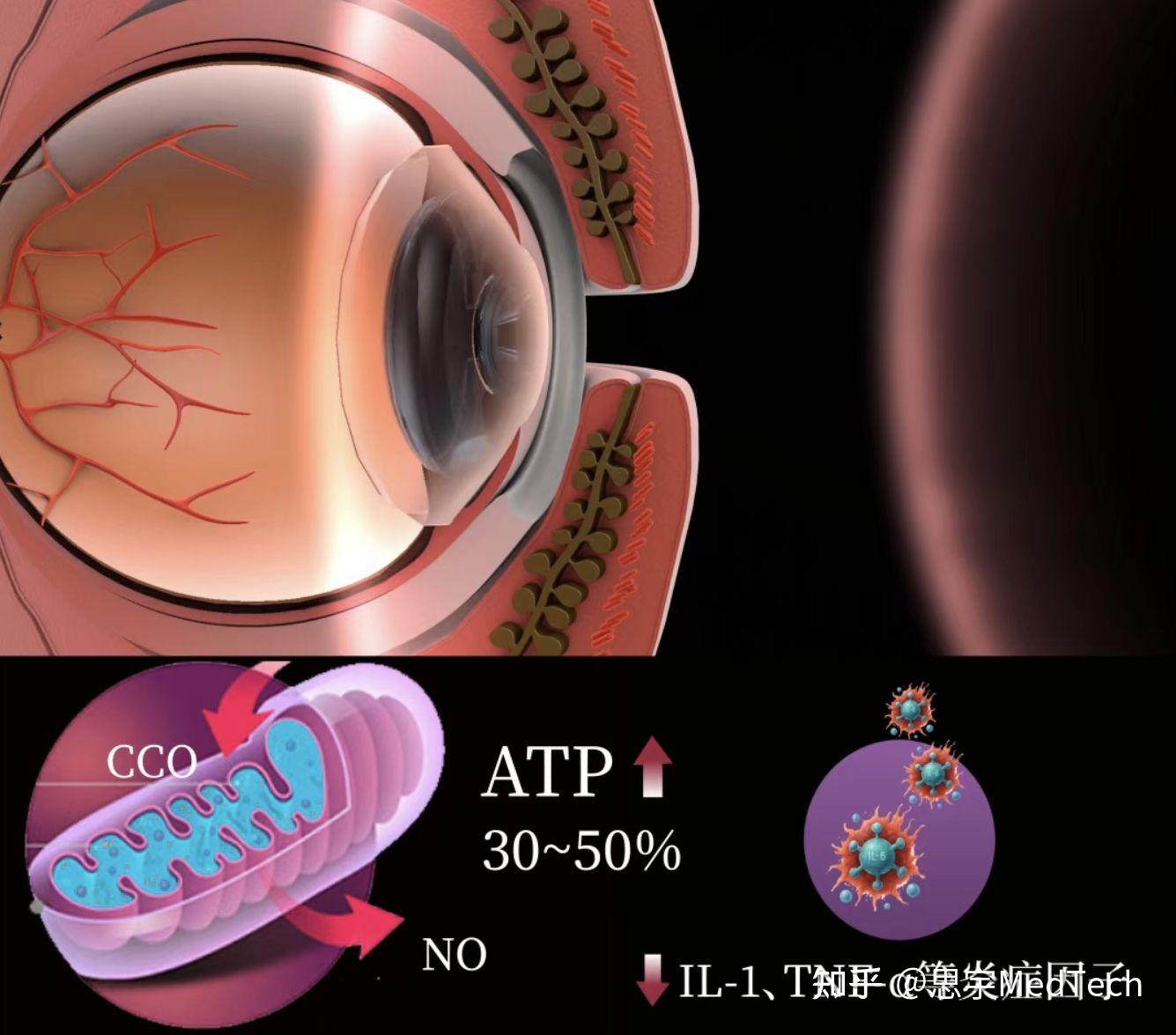 光生物疗法PBM，让干眼不再干：从干眼国际最新指南看光疗新希望 - 知乎
