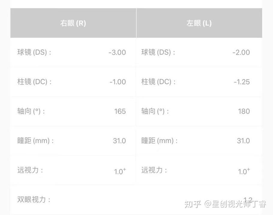 孩子的眼軸:k:角膜曲率,al:眼軸長度為孩子驗配了蔡司成長樂鏡片防控