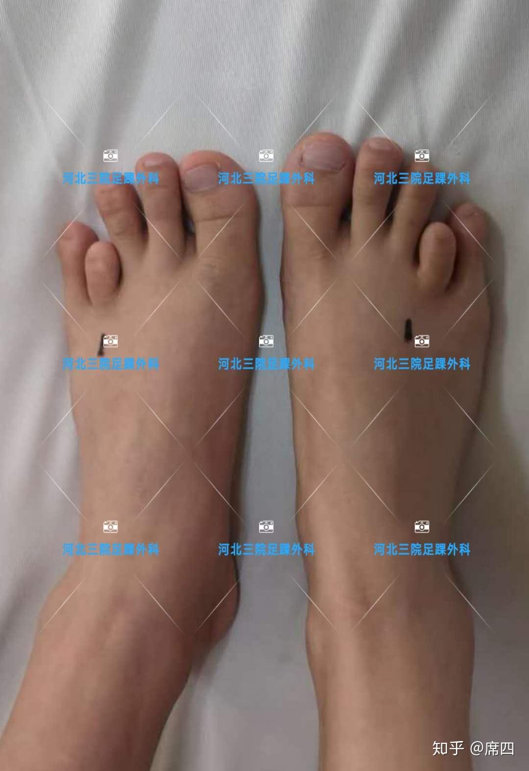 脚的各个部位详细图 精致足部解剖_华夏智能网