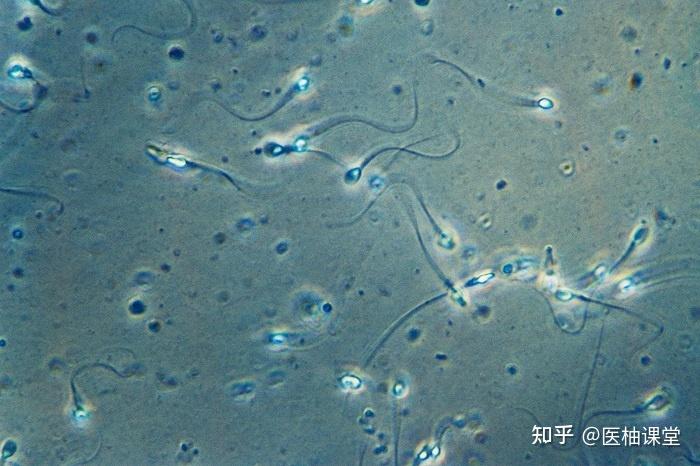 精液不液化的認知誤區