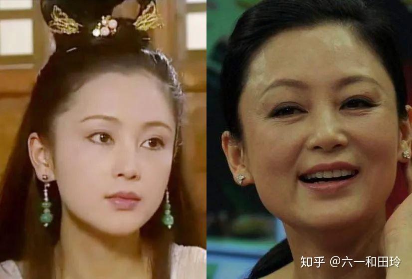 面部轮廓矫正_脸部轮廓改善_改善面部轮廓