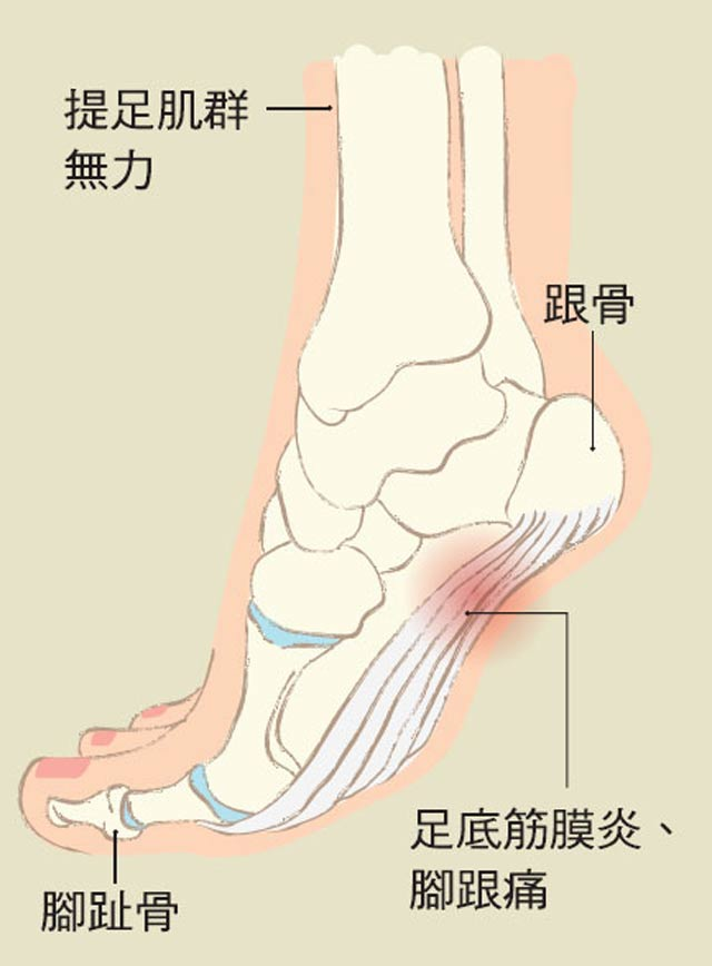 寿根骨图解图片