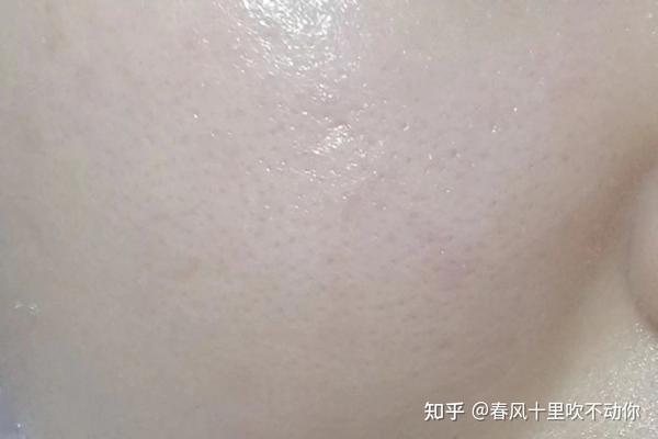 女生怎么样才能养好皮肤？ 知乎