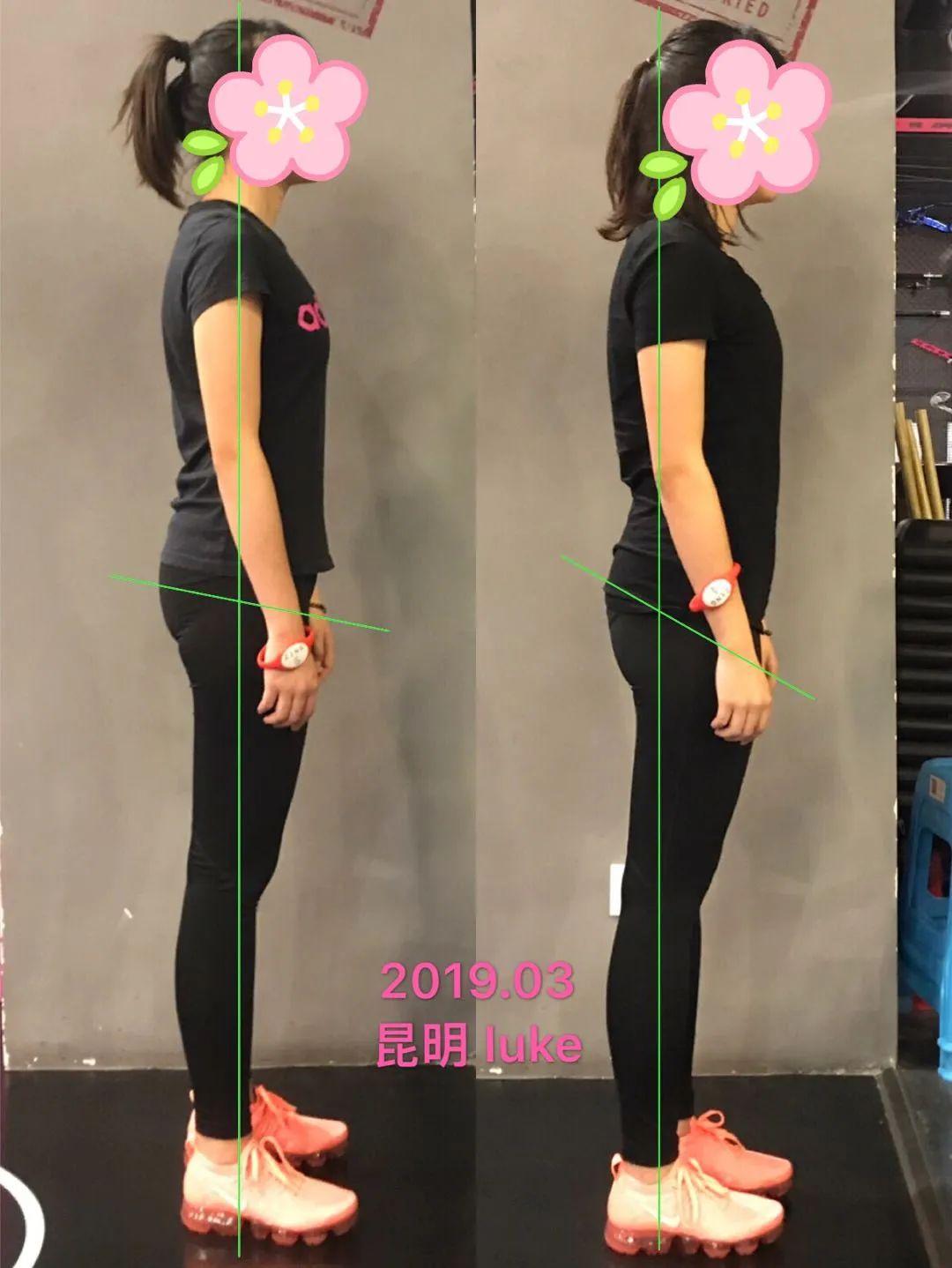 另外,自己一直想要改掉含胸驼背的习惯,从初中开始就试过很多方法