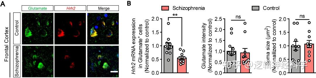 Pnas︱浙江大学胡薇薇 陈忠团队发现基于组胺h2受体的精神分裂症潜在药物靶标 知乎