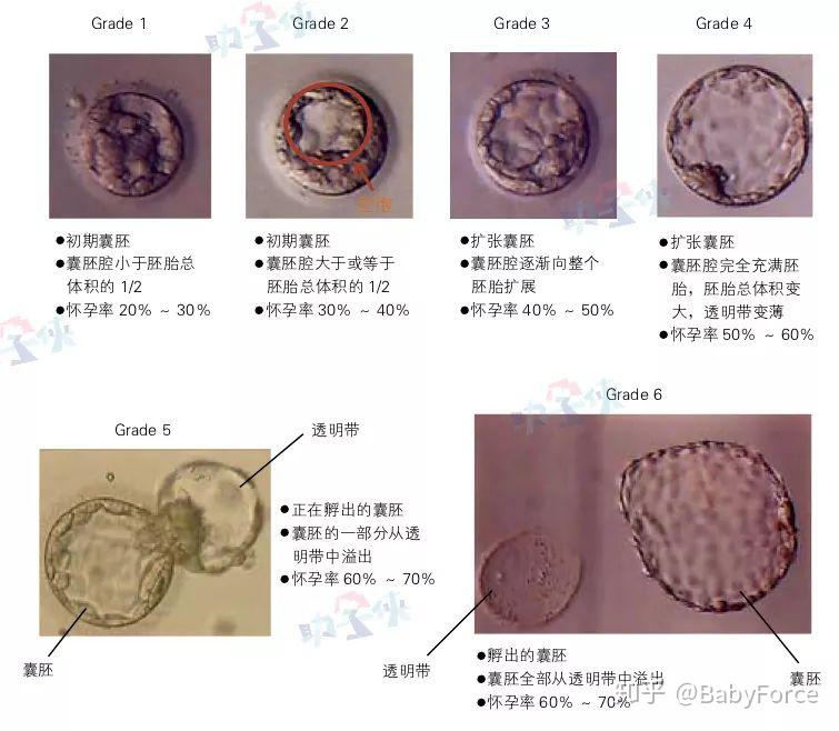 4aa囊胚图片图片