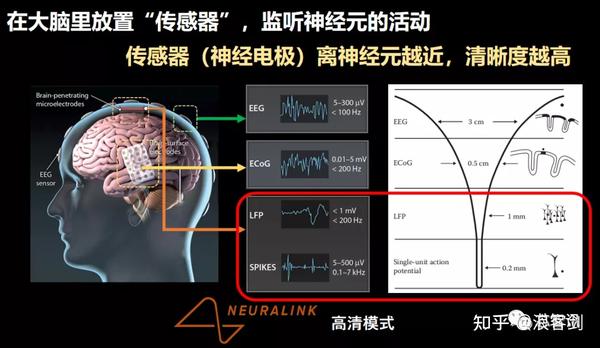 领先Neuralink！国产侵入式脑机接口技术进展神速：已完成多项临床实验！ - 知乎
