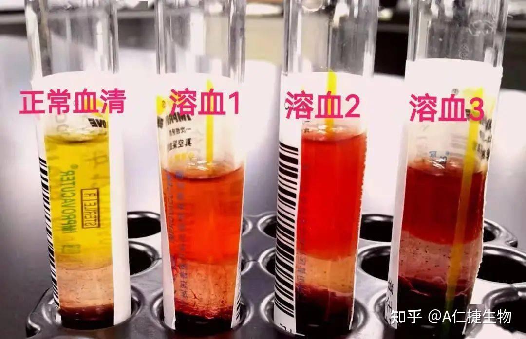 仁捷生物 | 科研人必知的血液样本采集/处理全攻略 - 知乎