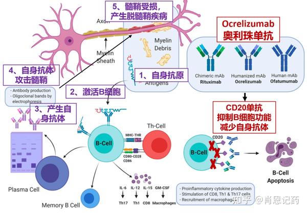 记住所有FDA生物药 | 靶向CD20 | Ocrevus®Ocrelizumab | 多发性硬化 MS - 知乎