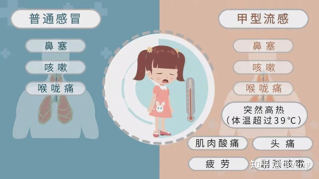 甲流感症状有哪些 zhuanlan.zhihu.com