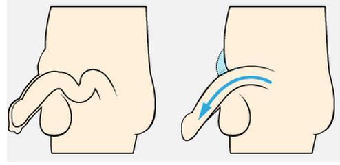 446 人 赞同了该文章 阴茎怎么增长增大增粗?