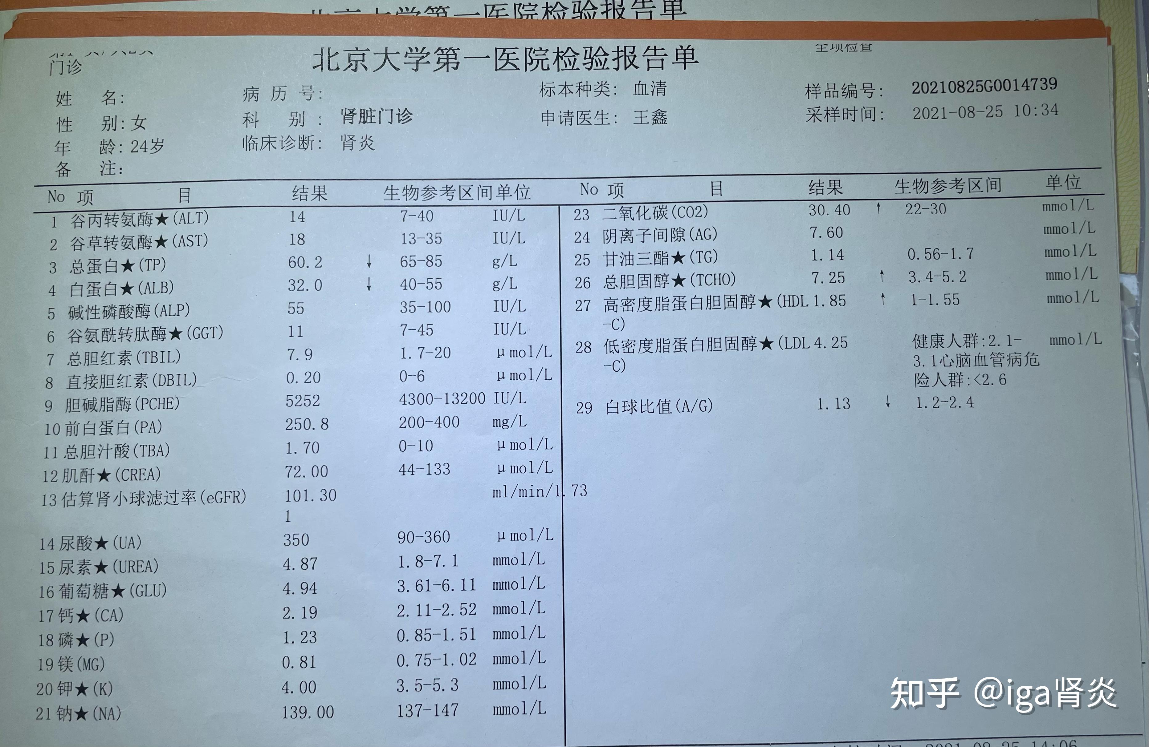 尿微量白蛋白80图片